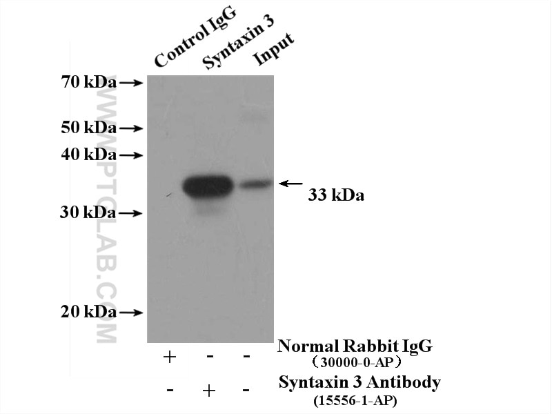 Immunoprecipitation (IP) experiment of SH-SY5Y cells using Syntaxin 3 Polyclonal antibody (15556-1-AP)