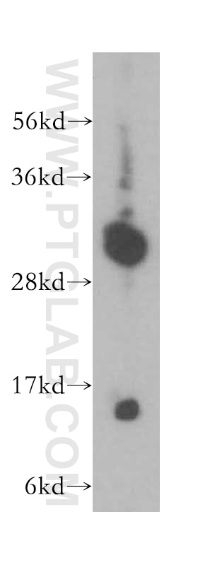 Western Blot (WB) analysis of human plasma using Syntaxin 3 Polyclonal antibody (15556-1-AP)