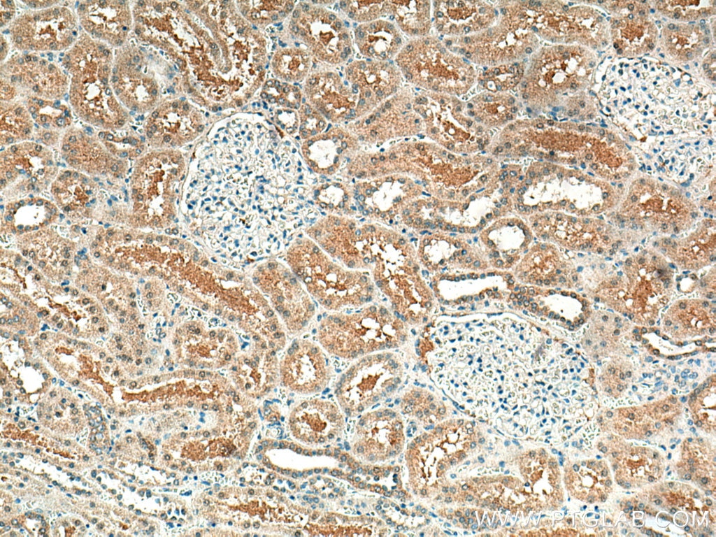 Immunohistochemistry (IHC) staining of human kidney tissue using STX3 Monoclonal antibody (66760-1-Ig)