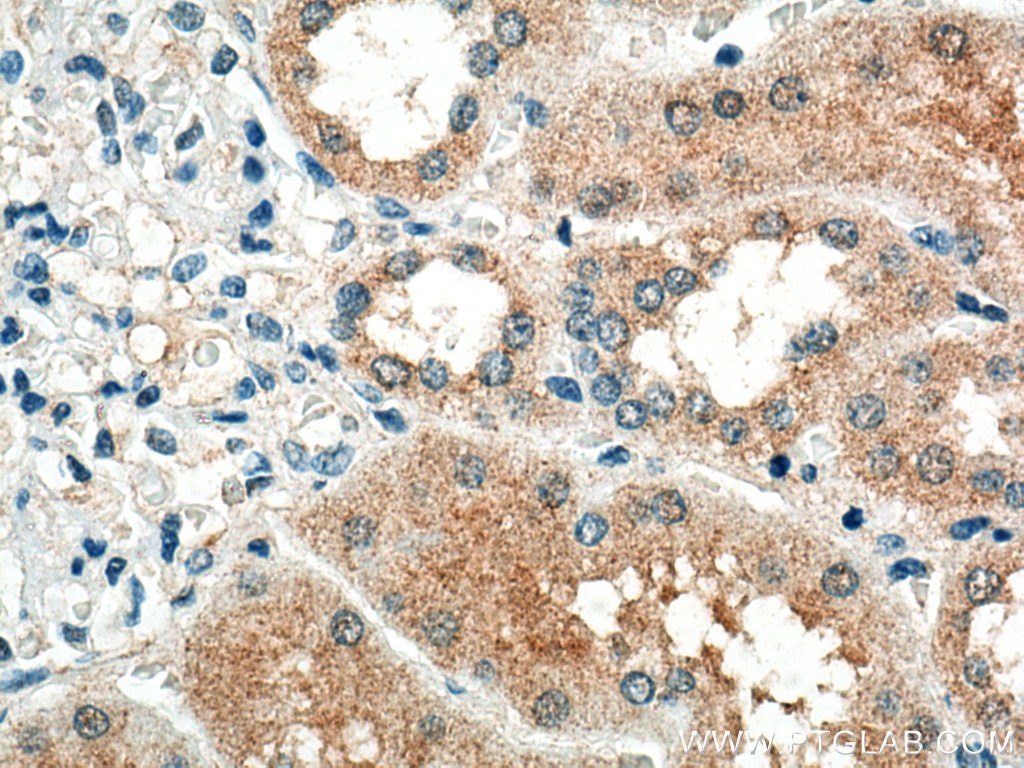 Immunohistochemistry (IHC) staining of human kidney tissue using STX3 Monoclonal antibody (66760-1-Ig)