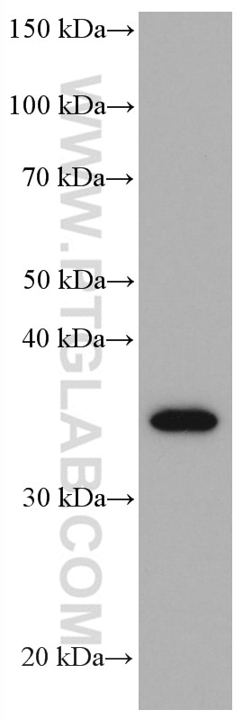 Western Blot (WB) analysis of SH-SY5Y cells using STX3 Monoclonal antibody (66760-1-Ig)