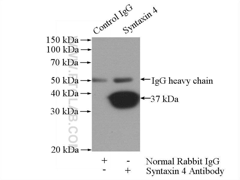 Immunoprecipitation (IP) experiment of mouse kidney tissue using Syntaxin 4 Polyclonal antibody (14988-1-AP)