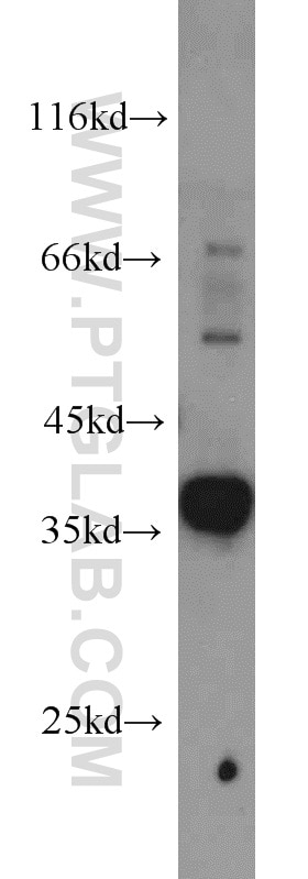 Western Blot (WB) analysis of rat kidney tissue using Syntaxin 4 Polyclonal antibody (14988-1-AP)