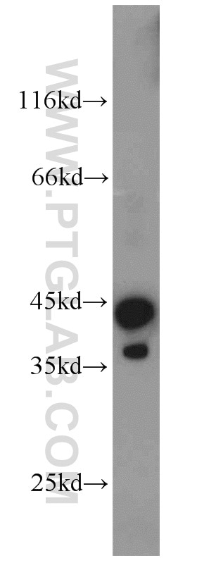 Western Blot (WB) analysis of mouse kidney tissue using Syntaxin 4 Polyclonal antibody (14988-1-AP)