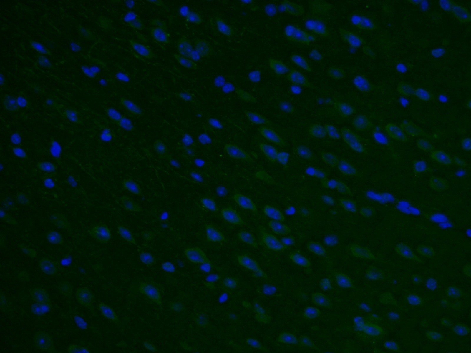 IF Staining of mouse brain using 26711-1-AP