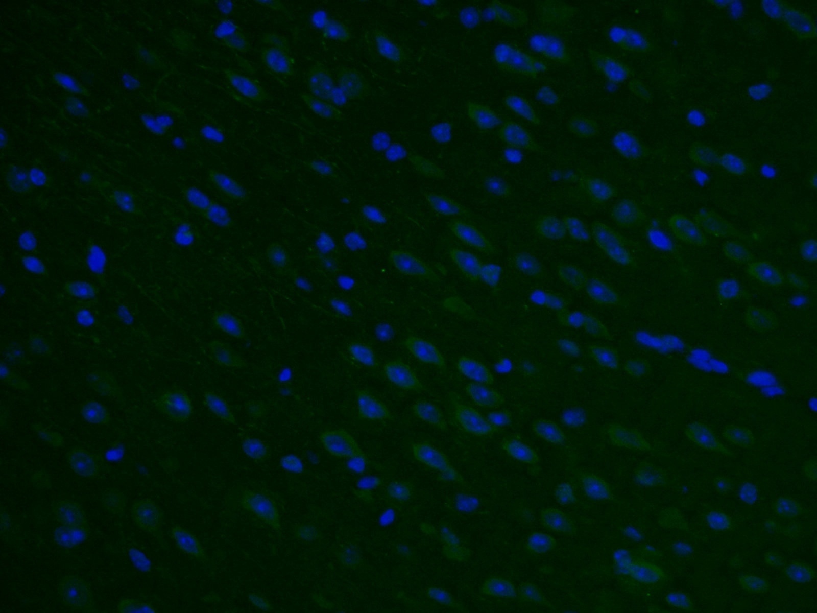 Immunofluorescence (IF) / fluorescent staining of mouse brain tissue using STX5 Polyclonal antibody (26711-1-AP)