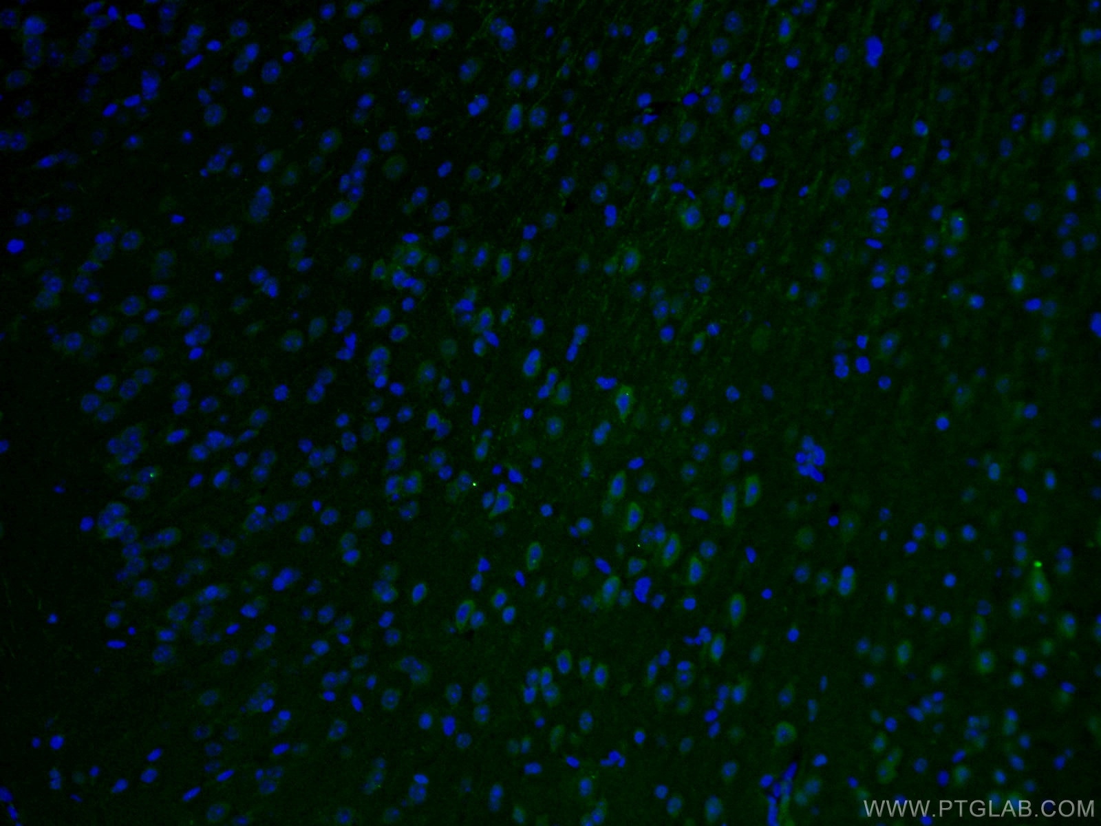 Immunofluorescence (IF) / fluorescent staining of mouse brain tissue using STX5 Polyclonal antibody (26711-1-AP)