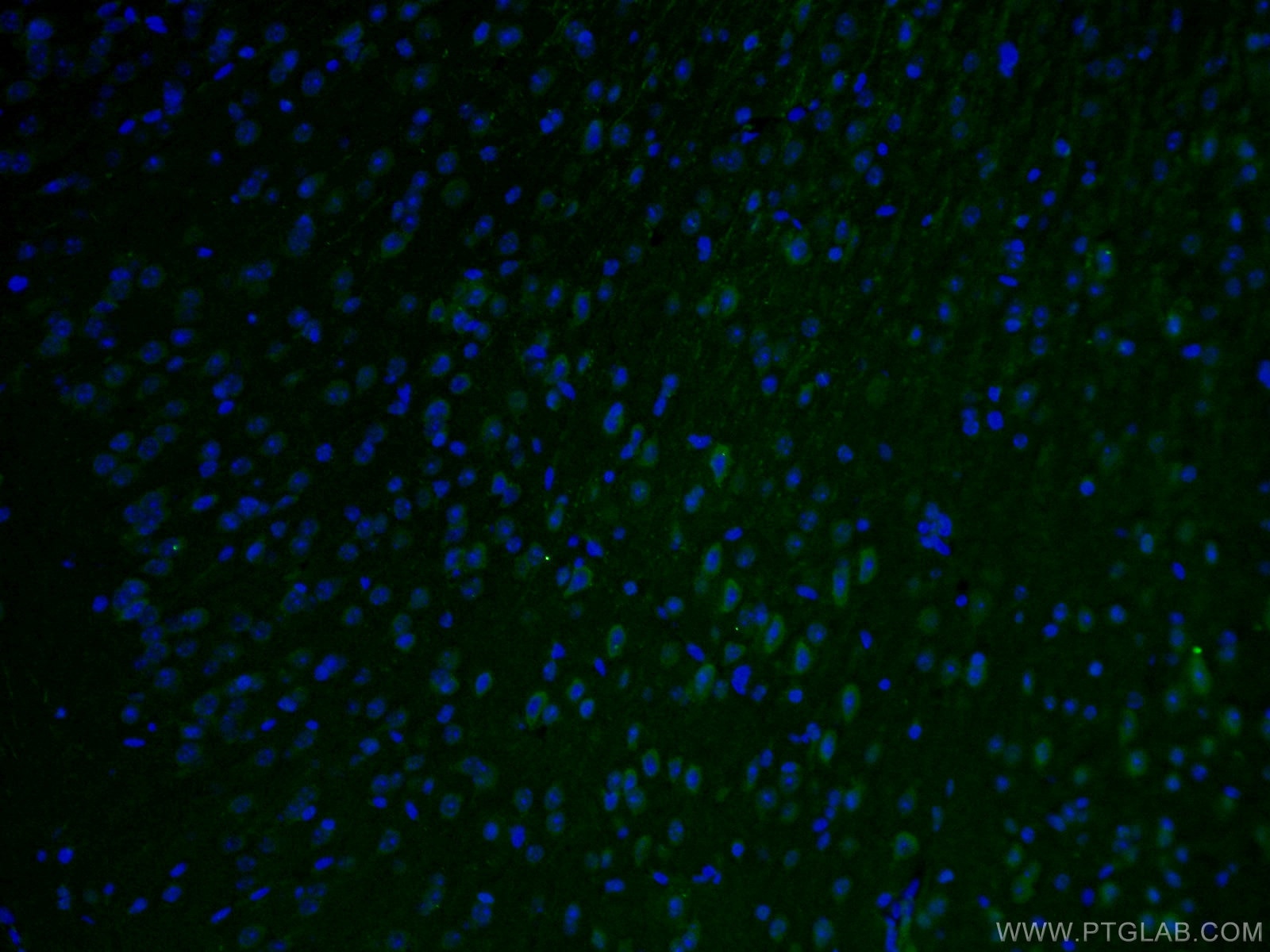 Immunofluorescence (IF) / fluorescent staining of mouse brain tissue using STX5 Polyclonal antibody (26711-1-AP)