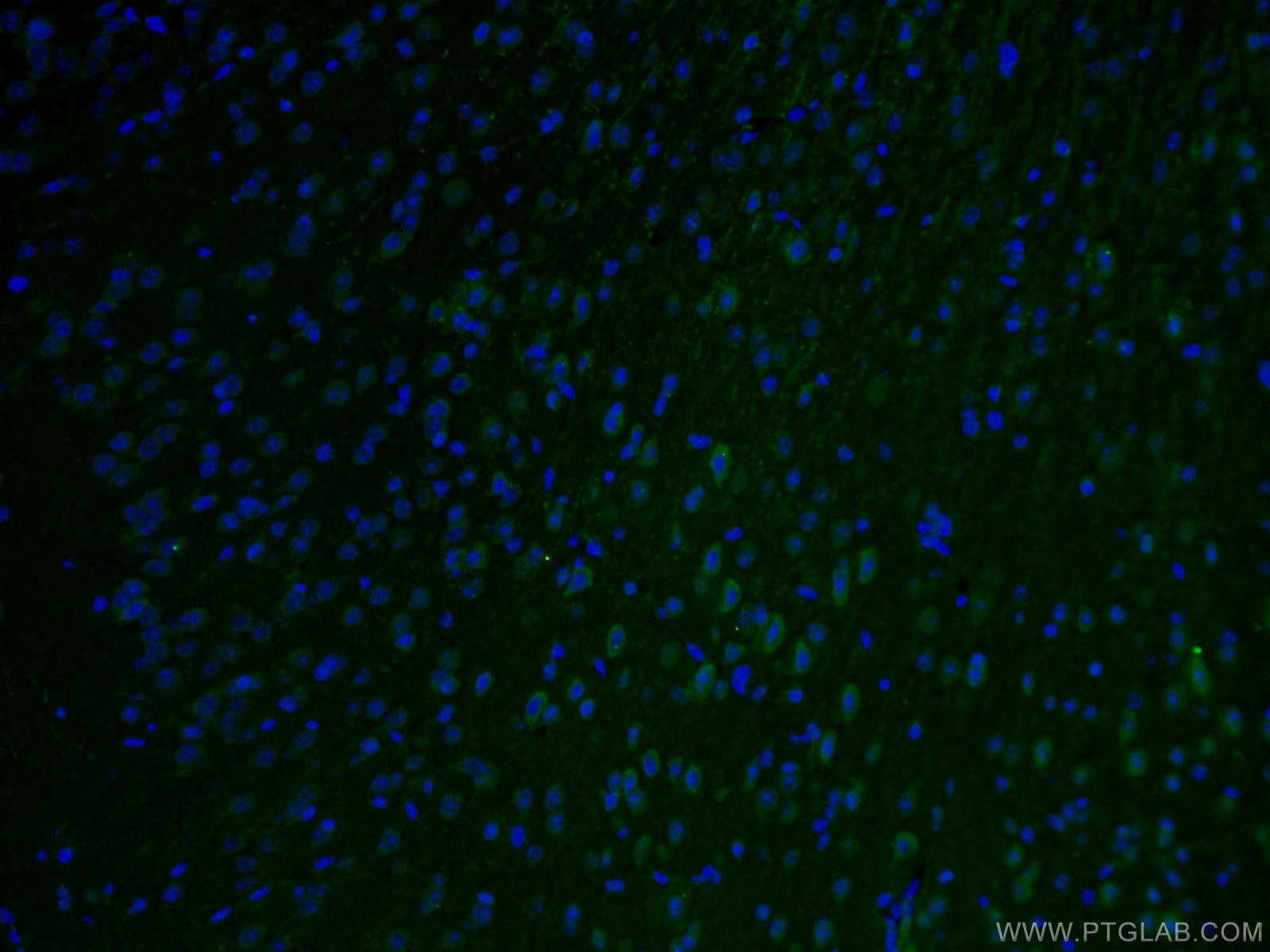 IF Staining of mouse brain using 26711-1-AP