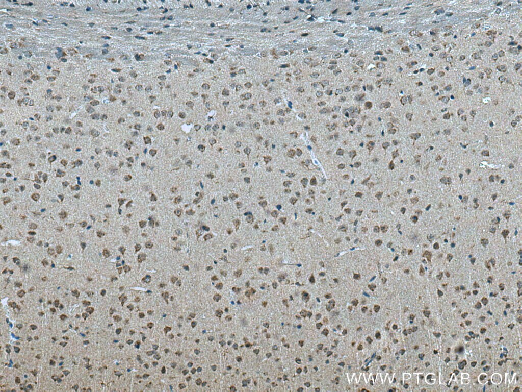 Immunohistochemistry (IHC) staining of mouse brain tissue using STX5 Polyclonal antibody (26711-1-AP)