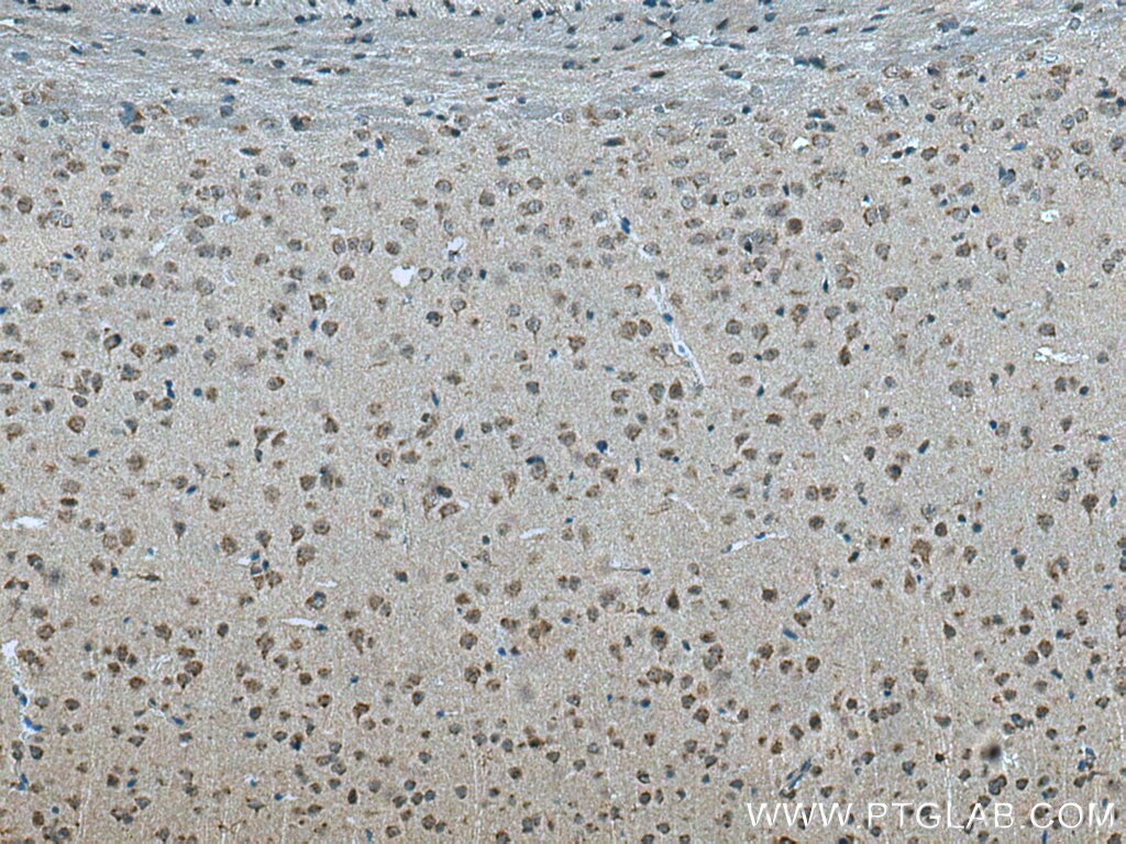 Immunohistochemistry (IHC) staining of mouse brain tissue using STX5 Polyclonal antibody (26711-1-AP)