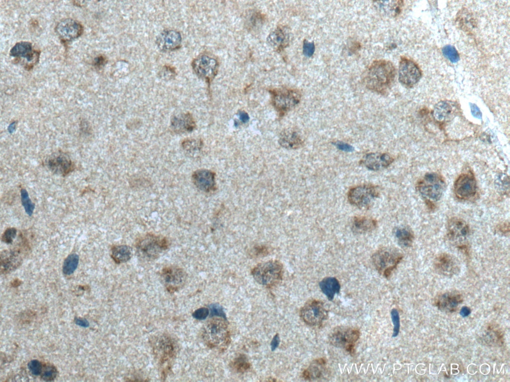 Immunohistochemistry (IHC) staining of mouse brain tissue using STX5 Polyclonal antibody (26711-1-AP)