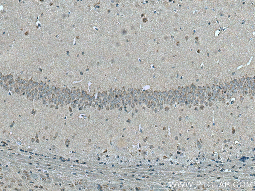 Immunohistochemistry (IHC) staining of mouse brain tissue using STX5 Polyclonal antibody (26711-1-AP)