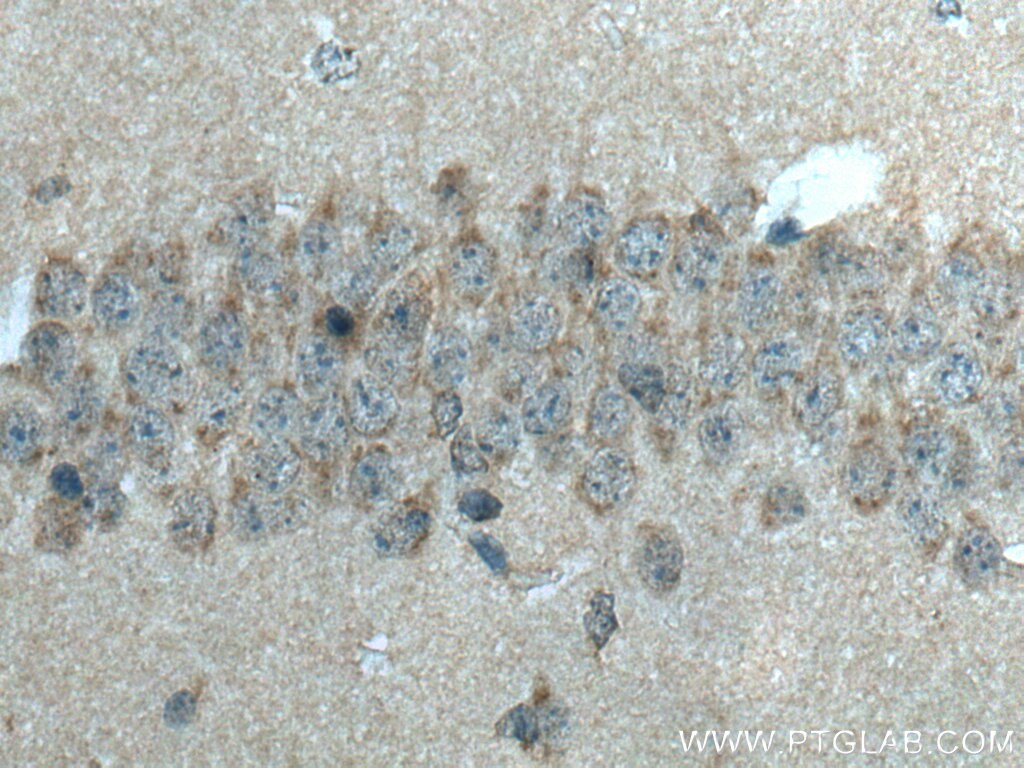 Immunohistochemistry (IHC) staining of mouse brain tissue using STX5 Polyclonal antibody (26711-1-AP)