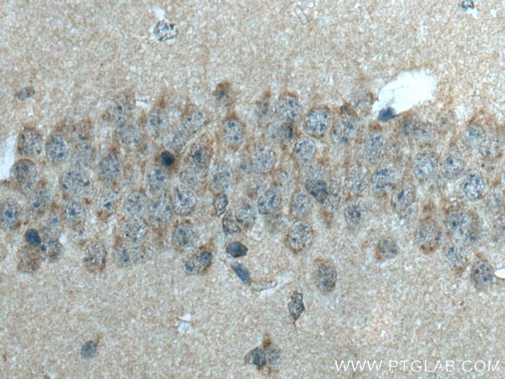 Immunohistochemistry (IHC) staining of mouse brain tissue using STX5 Polyclonal antibody (26711-1-AP)