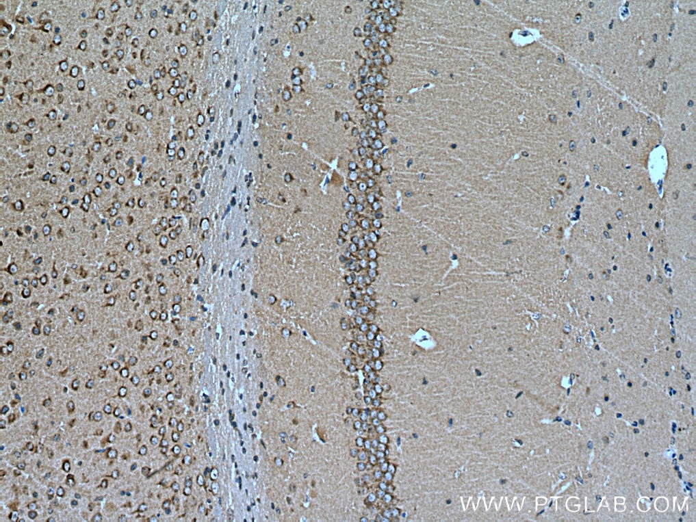 Immunohistochemistry (IHC) staining of mouse brain tissue using Syntaxin 6 Polyclonal antibody (10841-1-AP)
