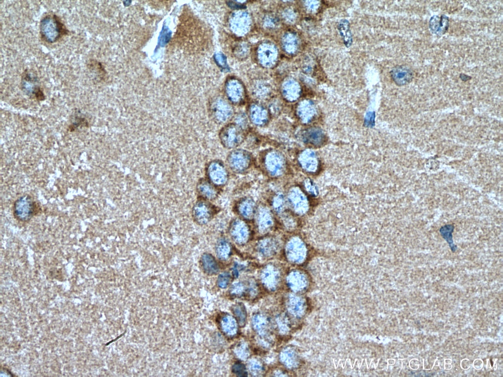 Immunohistochemistry (IHC) staining of mouse brain tissue using Syntaxin 6 Polyclonal antibody (10841-1-AP)