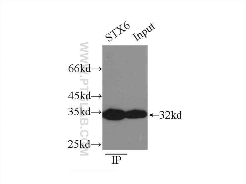 Immunoprecipitation (IP) experiment of mouse brain tissue using Syntaxin 6 Polyclonal antibody (10841-1-AP)
