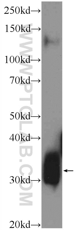 Western Blot (WB) analysis of rat brain tissue using Syntaxin 6 Polyclonal antibody (10841-1-AP)