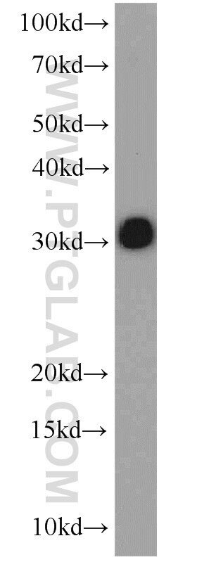 Western Blot (WB) analysis of human brain tissue using Syntaxin 6 Polyclonal antibody (10841-1-AP)