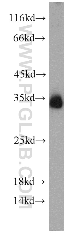 Western Blot (WB) analysis of mouse brain tissue using Syntaxin 6 Polyclonal antibody (10841-1-AP)