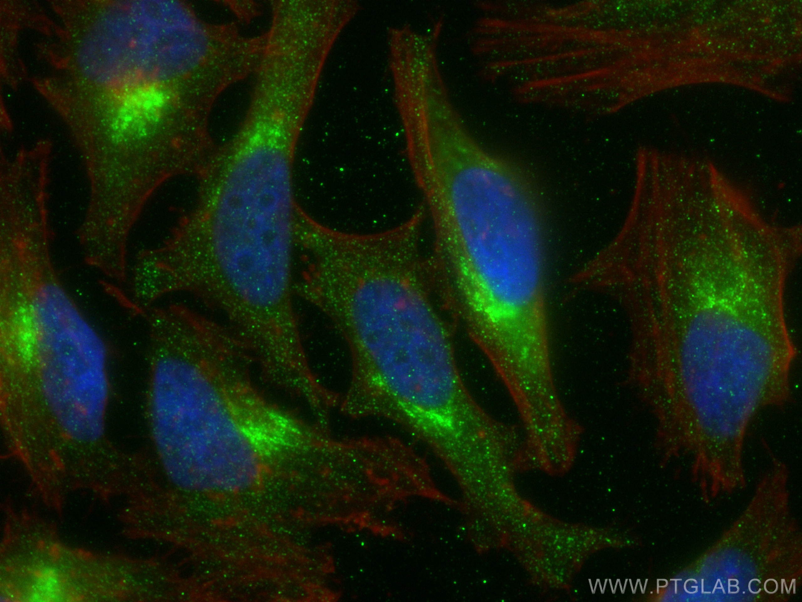 Immunofluorescence (IF) / fluorescent staining of HeLa cells using Syntaxin 6 Monoclonal antibody (60059-1-Ig)