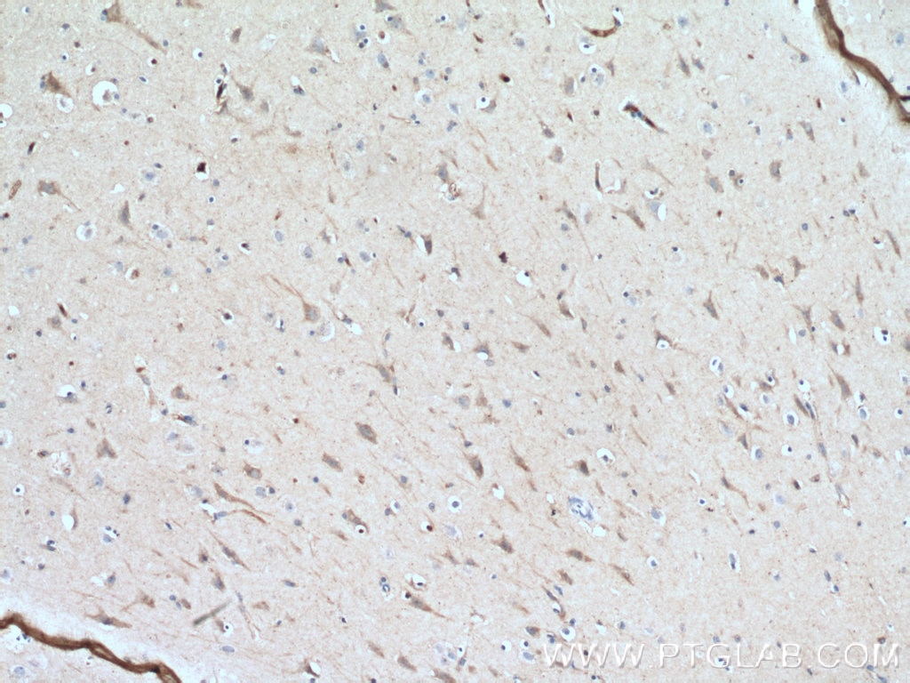 Immunohistochemistry (IHC) staining of human brain tissue using Syntaxin 6 Monoclonal antibody (60059-1-Ig)