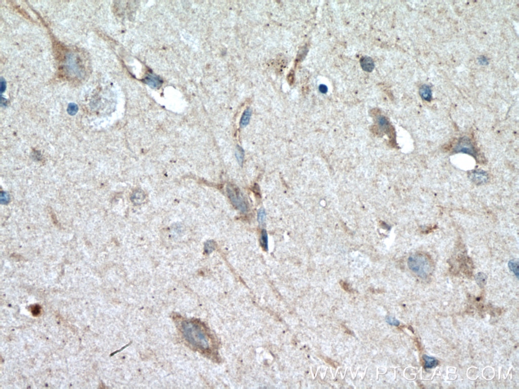 Immunohistochemistry (IHC) staining of human brain tissue using Syntaxin 6 Monoclonal antibody (60059-1-Ig)