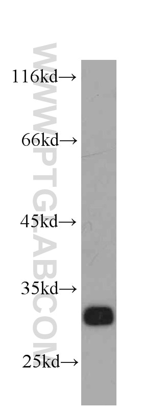 Western Blot (WB) analysis of Jurkat cells using Syntaxin 6 Monoclonal antibody (60059-1-Ig)