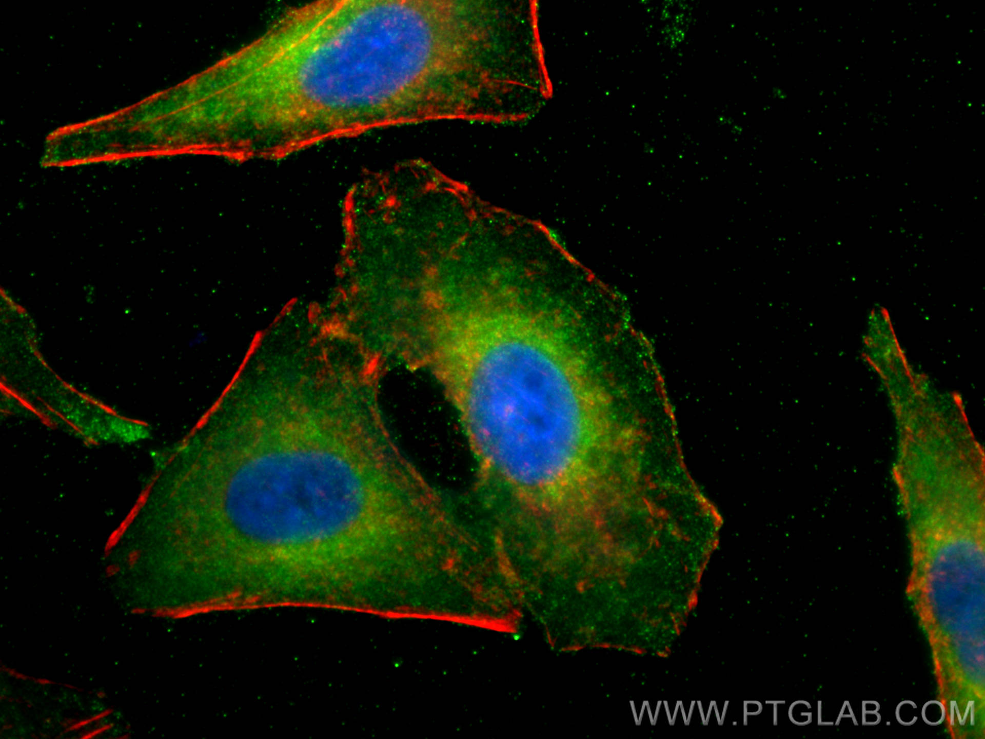 Immunofluorescence (IF) / fluorescent staining of A549 cells using Syntaxin 7 Polyclonal antibody (12322-1-AP)