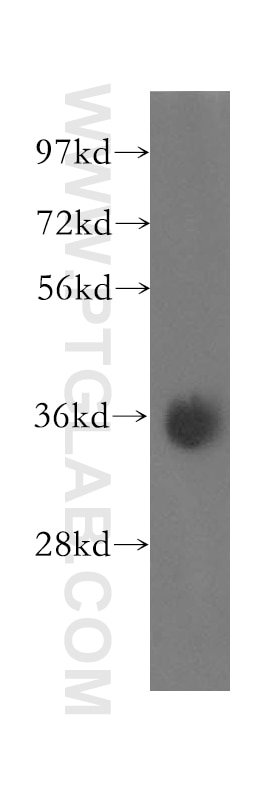 Western Blot (WB) analysis of human liver tissue using Syntaxin 7 Polyclonal antibody (12322-1-AP)