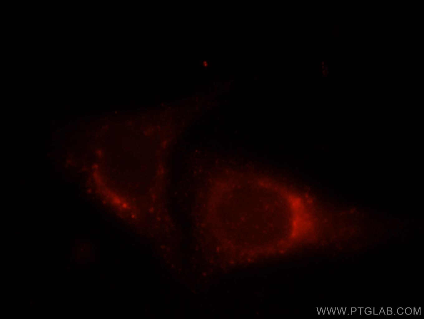 Immunofluorescence (IF) / fluorescent staining of HepG2 cells using Syntaxin 8 Polyclonal antibody (12206-1-AP)
