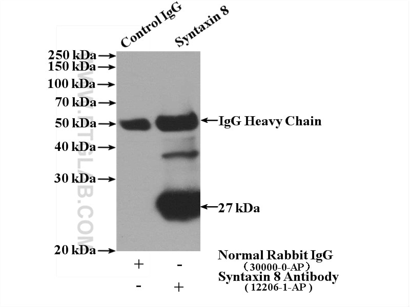 Immunoprecipitation (IP) experiment of A375 cells using Syntaxin 8 Polyclonal antibody (12206-1-AP)