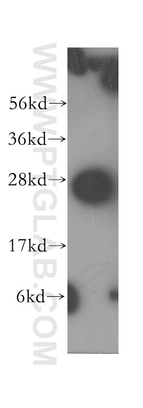 Western Blot (WB) analysis of human kidney tissue using Syntaxin 8 Polyclonal antibody (12206-1-AP)