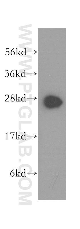 Western Blot (WB) analysis of human brain tissue using Syntaxin 8 Polyclonal antibody (12206-1-AP)