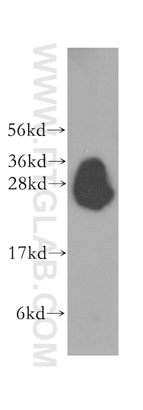 Western Blot (WB) analysis of human placenta tissue using Syntaxin 8 Polyclonal antibody (12206-1-AP)