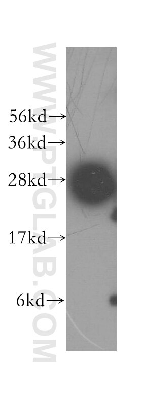 Western Blot (WB) analysis of human liver tissue using Syntaxin 8 Polyclonal antibody (12206-1-AP)