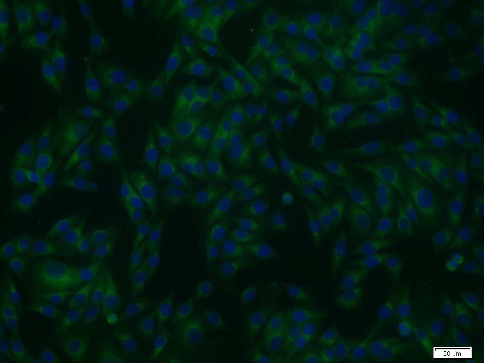 Immunofluorescence (IF) / fluorescent staining of A375 cells using STXBP1 Polyclonal antibody (11459-1-AP)