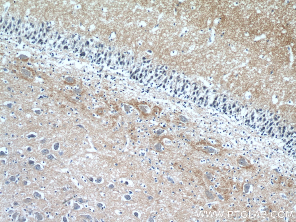 Immunohistochemistry (IHC) staining of human brain tissue using STXBP1 Polyclonal antibody (11459-1-AP)
