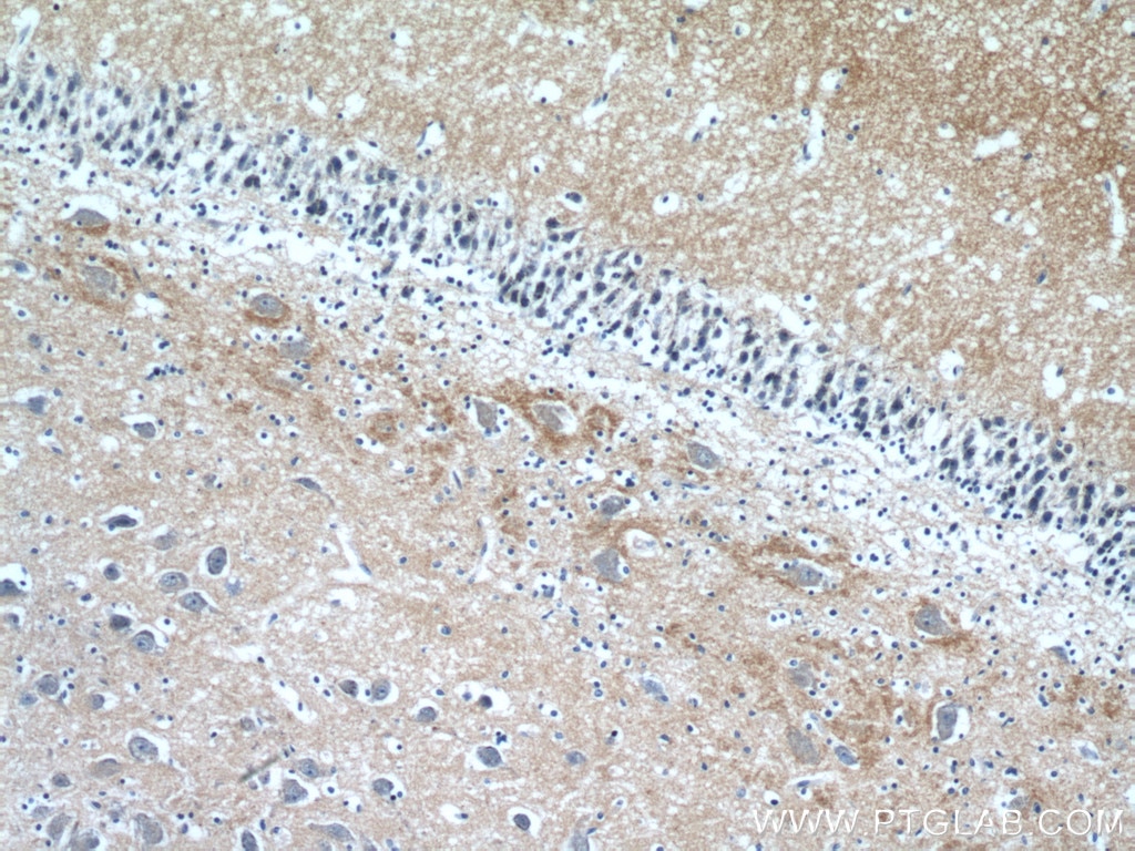 IHC staining of human brain using 11459-1-AP