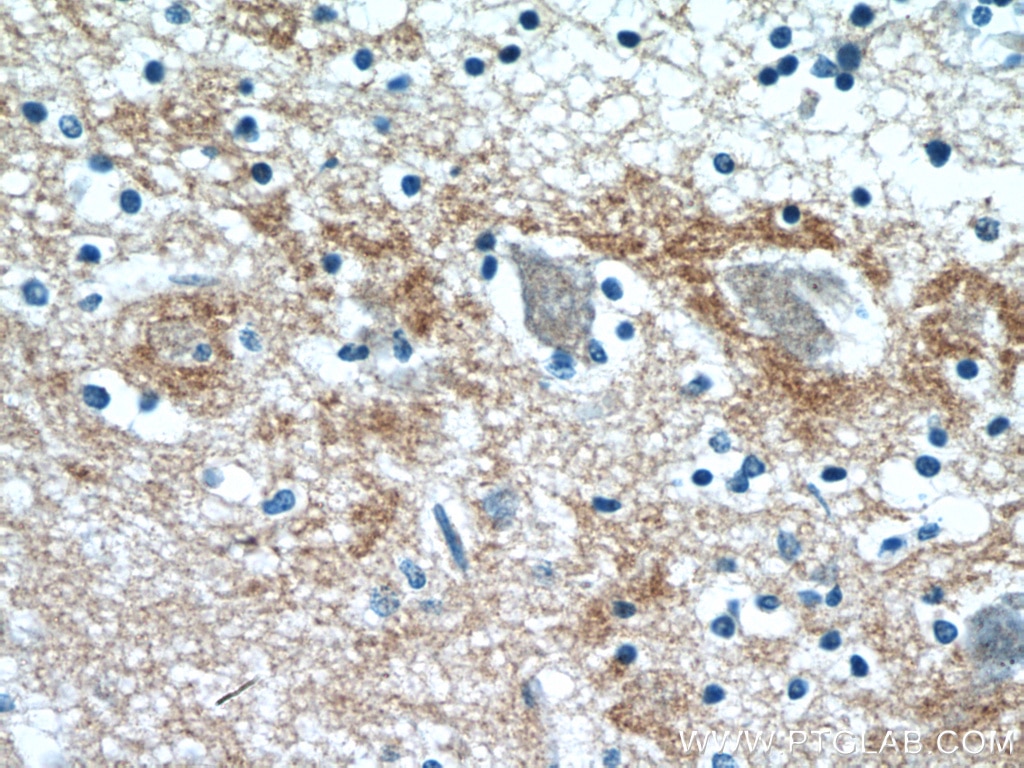 Immunohistochemistry (IHC) staining of human brain tissue using STXBP1 Polyclonal antibody (11459-1-AP)