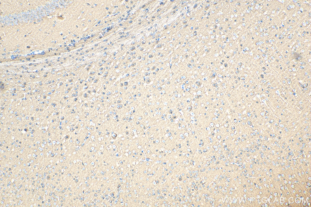 Immunohistochemistry (IHC) staining of mouse brain tissue using STXBP1 Polyclonal antibody (11459-1-AP)