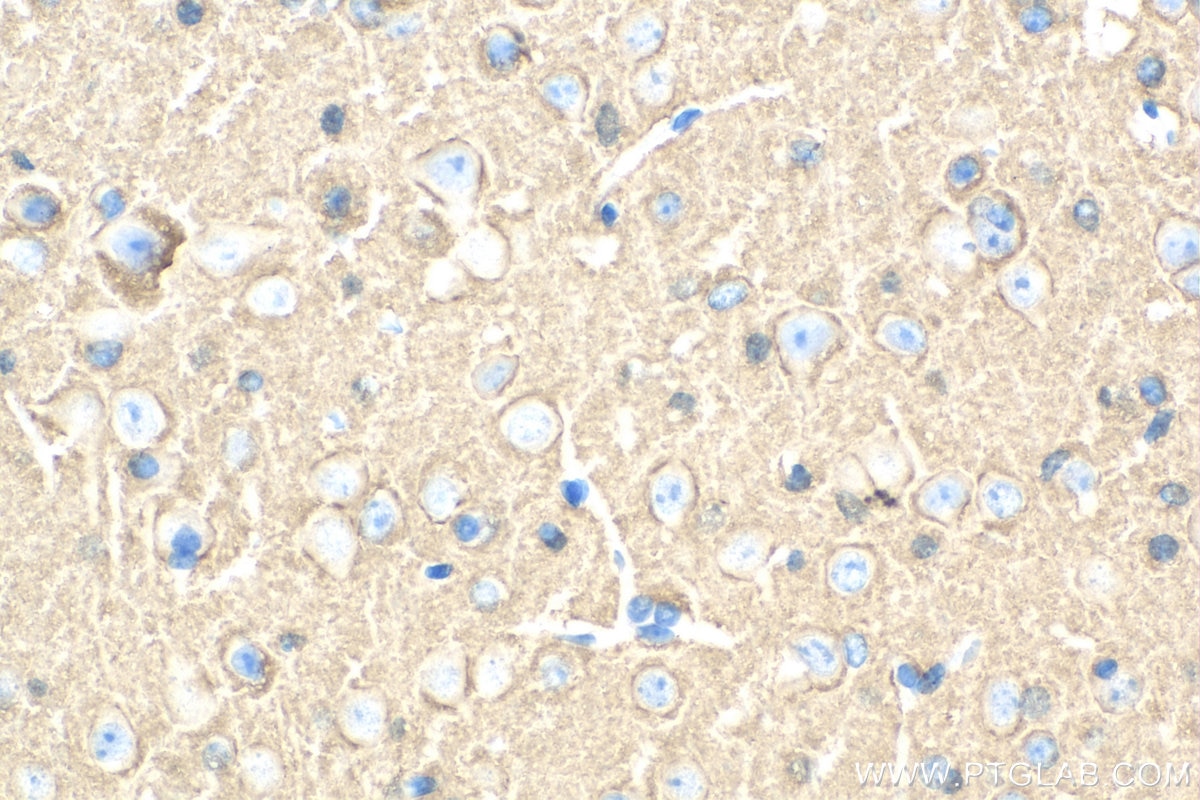 Immunohistochemistry (IHC) staining of mouse brain tissue using STXBP1 Polyclonal antibody (11459-1-AP)