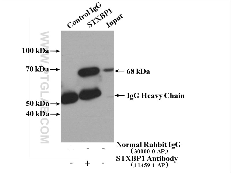 Immunoprecipitation (IP) experiment of HeLa cells using STXBP1 Polyclonal antibody (11459-1-AP)