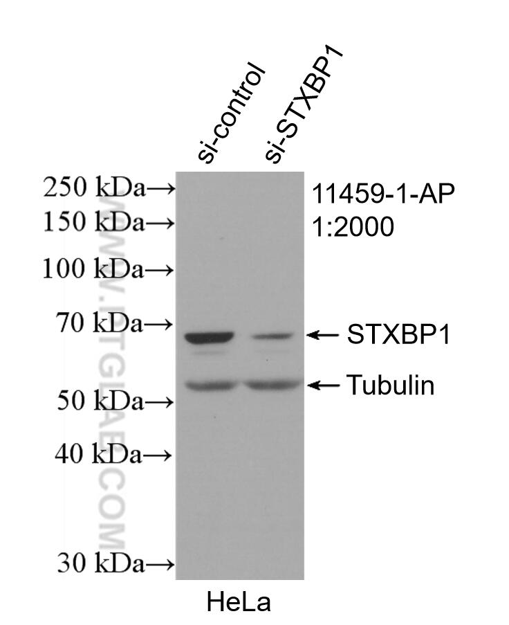 Western Blot (WB) analysis of HeLa cells using STXBP1 Polyclonal antibody (11459-1-AP)