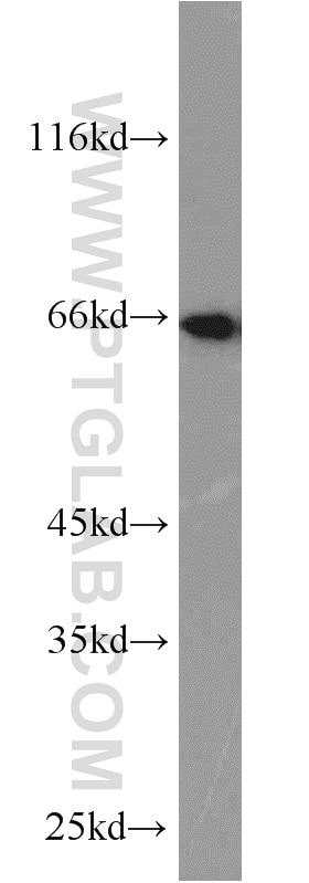 Western Blot (WB) analysis of A375 cells using STXBP1 Polyclonal antibody (11459-1-AP)