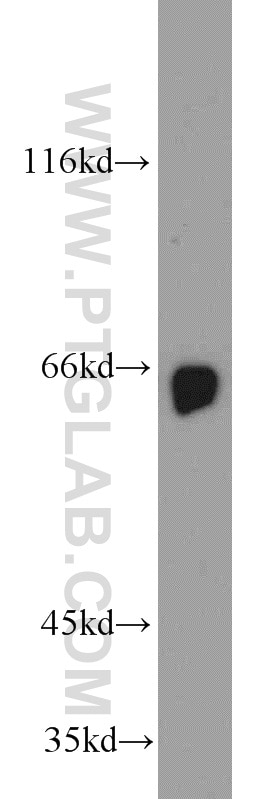 Western Blot (WB) analysis of Y79 cells using STXBP1 Polyclonal antibody (11459-1-AP)