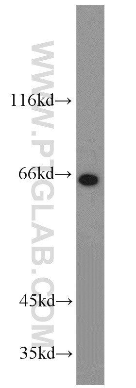 Western Blot (WB) analysis of HeLa cells using STXBP1 Polyclonal antibody (11459-1-AP)