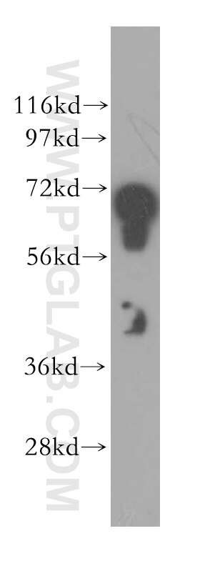 Western Blot (WB) analysis of human brain tissue using STXBP1 Polyclonal antibody (11459-1-AP)