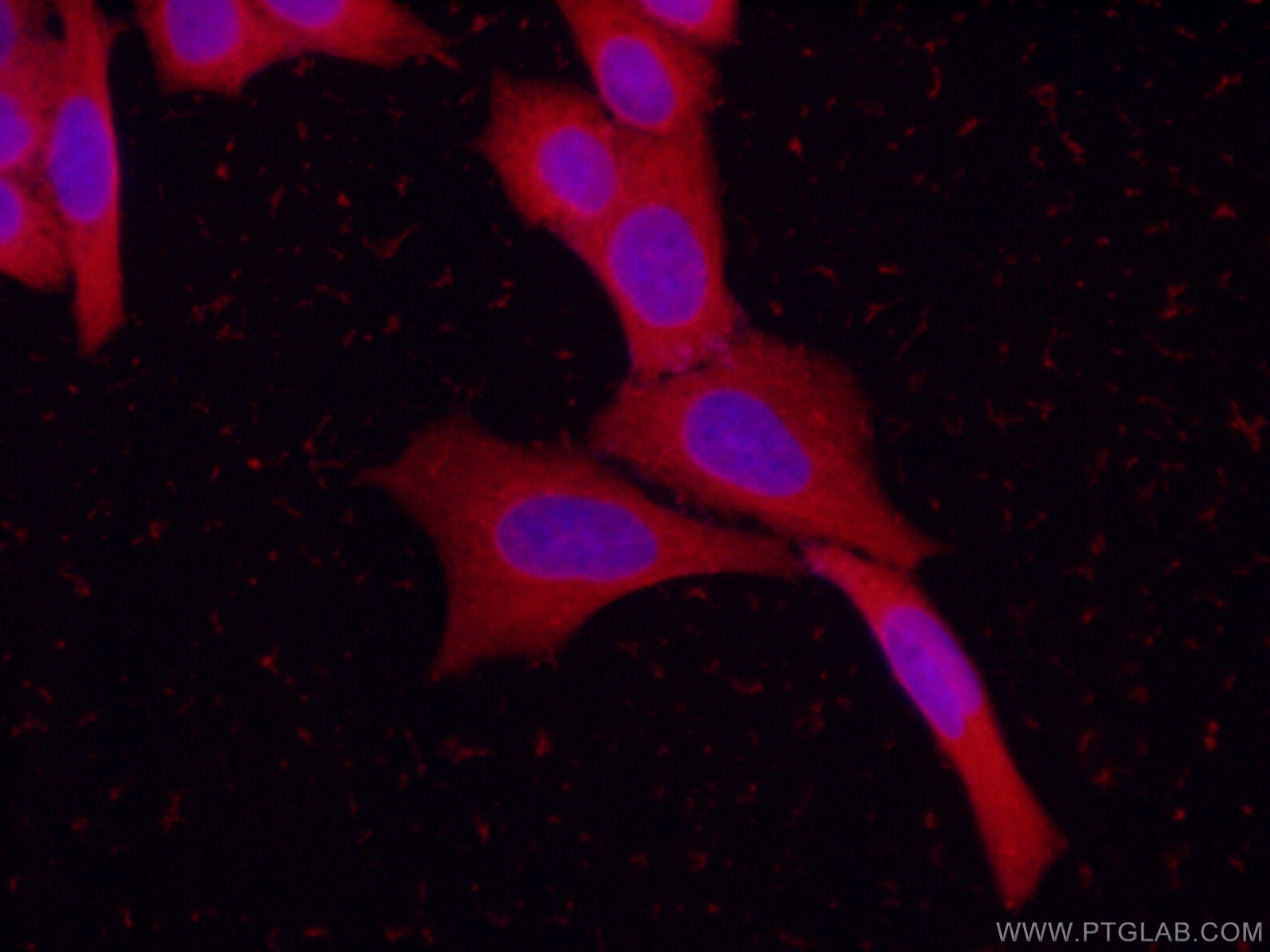 Immunofluorescence (IF) / fluorescent staining of HeLa cells using STXBP1 Polyclonal antibody (20562-1-AP)